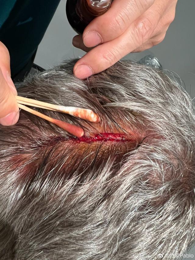 hs, http, 室也和恩加 hs, http, 室也和恩加